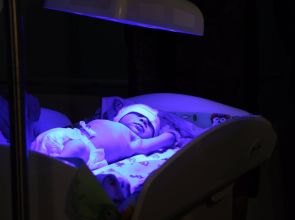 Фототерапия от желтушки. Клинические рекомендации